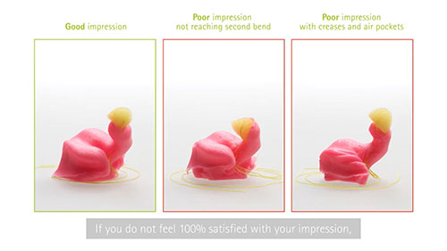 如何制取耳印模