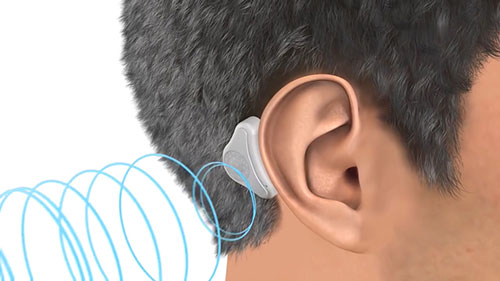 爱笛骨导助听器的工作原理
