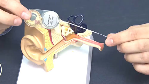 助听器的原理和结构