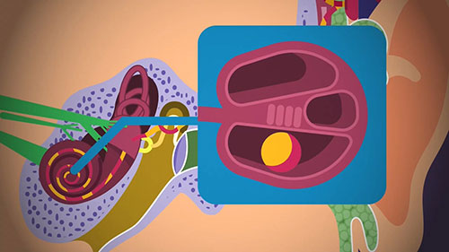 什么是人工耳蜗