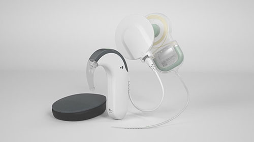 人工耳蜗的工作原理