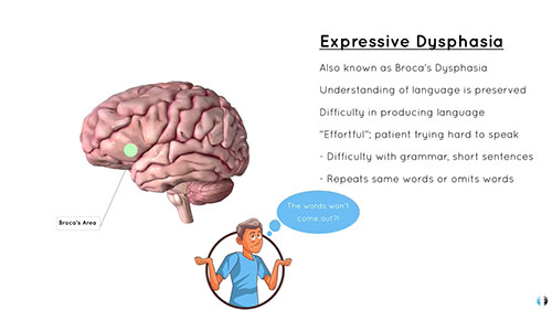 构音障碍与吞咽障碍