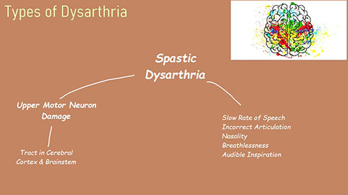 详细介绍构音障碍