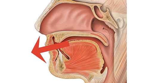 腭裂语音的评估