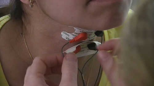 卒中后吞咽治疗