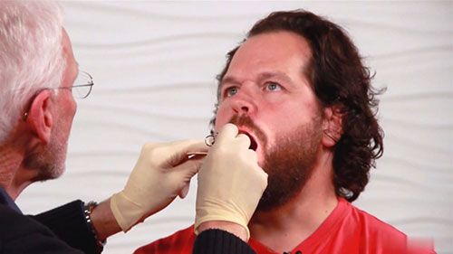 吞咽障碍的临床评估