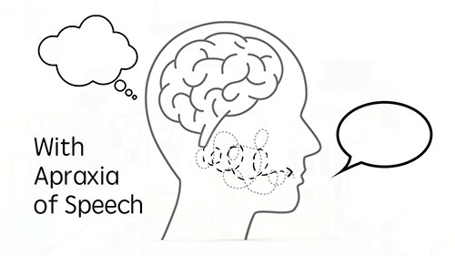 什么是言语失用