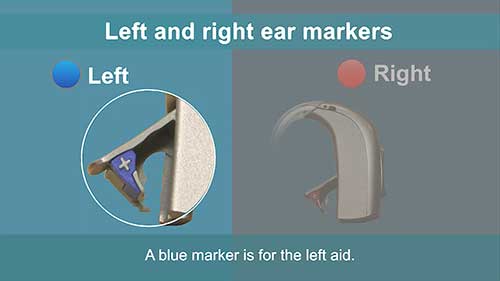 助听器01概述