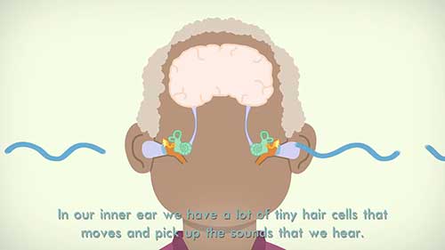 感音神经性听力损失