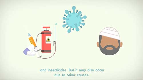 突发性听力障碍