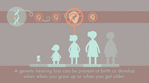遗传性听力损失