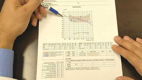 教你读懂听力检查表