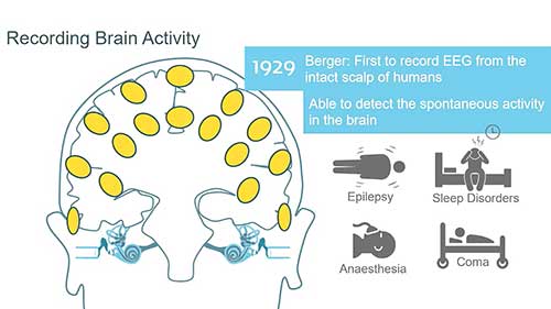 听性脑干反应01