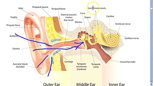 骨传导植入式听力解决方案