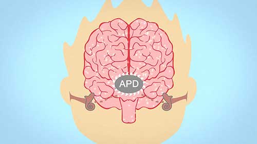 什么是听觉处理障碍