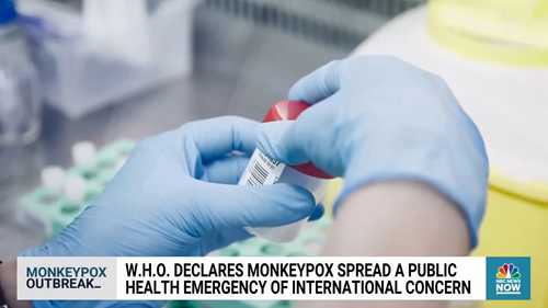 世卫组织宣布猴痘为公共卫生紧急事件
