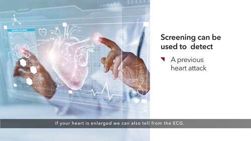 什么是心脏筛查