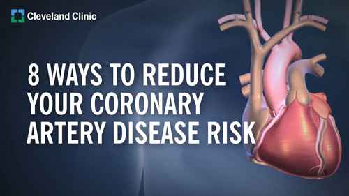 如何降低冠状动脉疾病风险