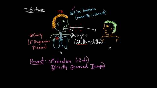 预防结核病的传播