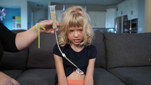 使用注射器推注营养