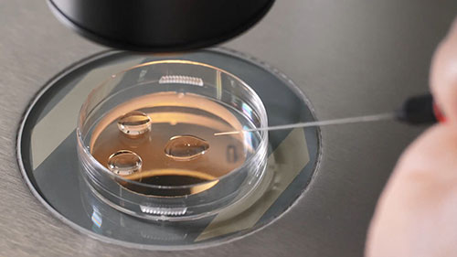 宫腔内人工授精与体外受精的区别