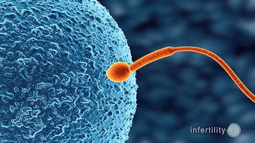 男性不育的精子检测