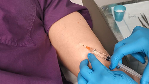 植入式避孕棒的取出与更换