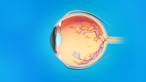 视网膜血管造影