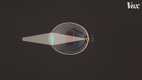 为什么戴眼镜的人越来越多