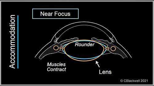 老视：为什么需要老视镜
