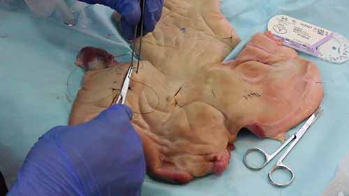 四种简单的缝合技术