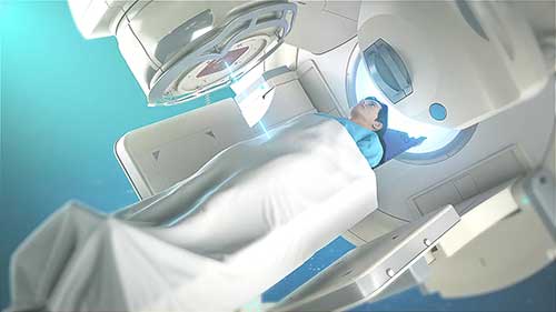 近距离放射治疗