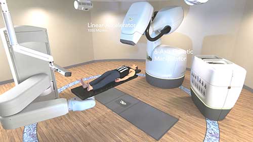 射波刀的工作原理