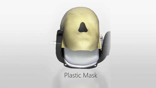 伽马刀治疗——面罩固定