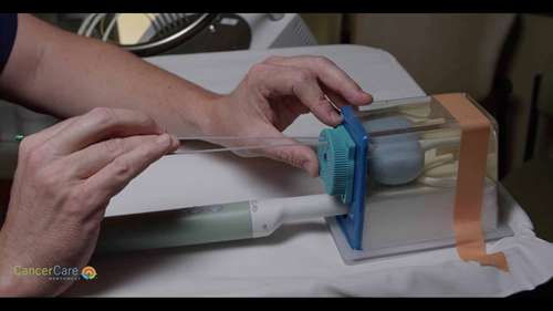 医生如何进行近距离放射治疗