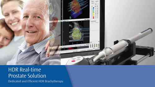 前列腺近距离放射治疗