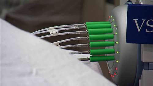 乳腺癌快速治疗方案