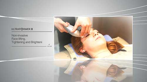 UltraformerIII超声波溶脂刀