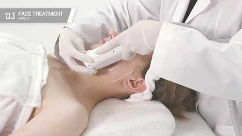 高强度聚焦超声仪的使用