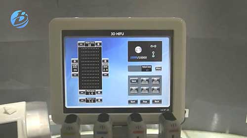 便携式高强度聚焦超声仪