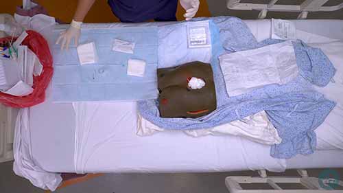 护理技能：伤口护理换药