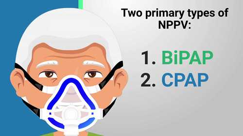 双水平气道正压通气与持续气道正压通气