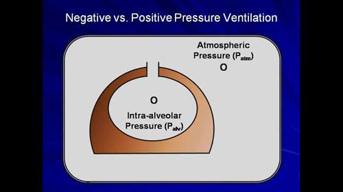 机械通气讲座 01 概论