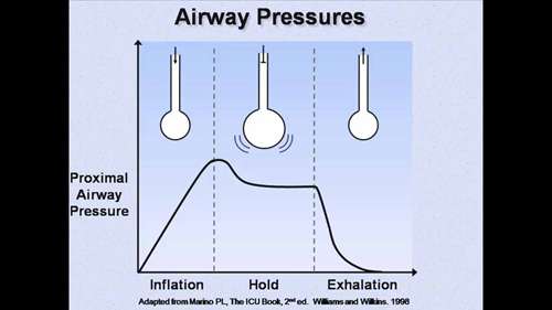 机械通气讲座 03 呼吸力学监测