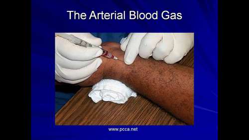 机械通气讲座 05 气体交换监测