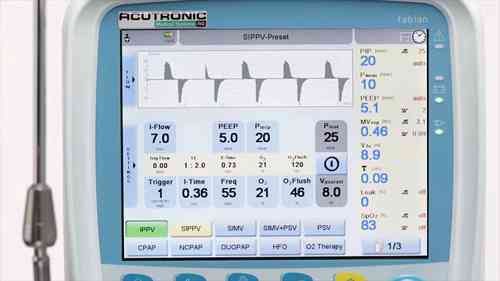 菲萍新生儿呼吸机——SIPPV模式