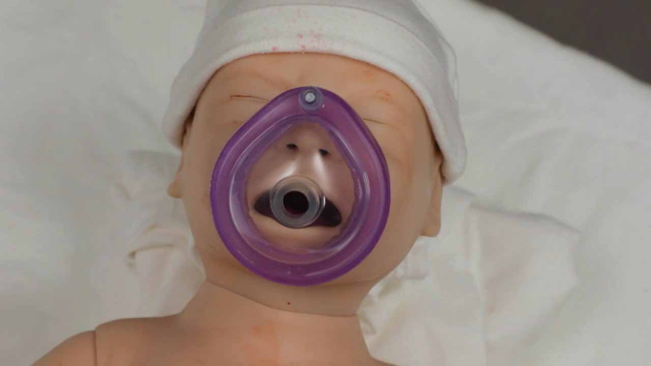 新生儿面罩正压通气