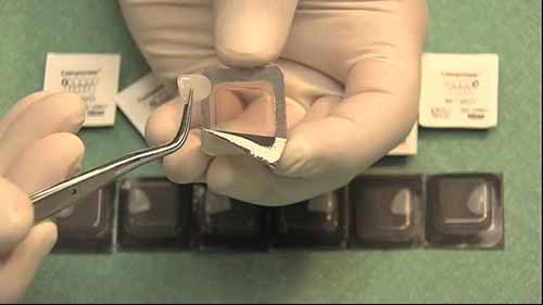 单诊美齿奈米片临床应用