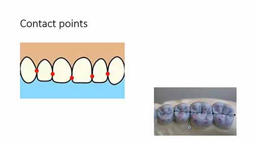 牙体解剖学基本词汇