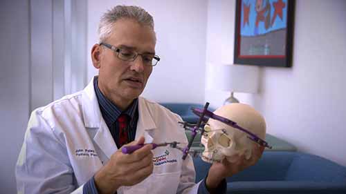 颌面外科牵张成骨术